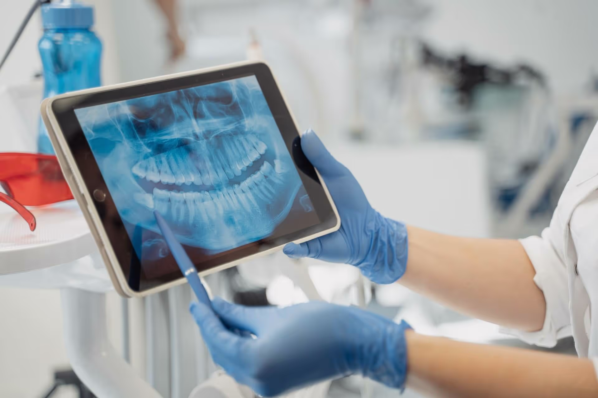 Smile Makeover